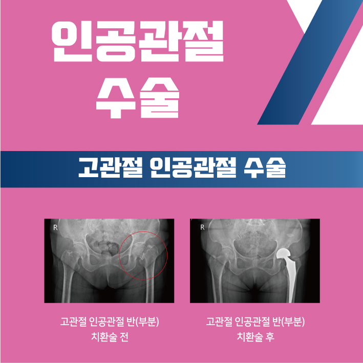 5c9468da3a27737.jpg