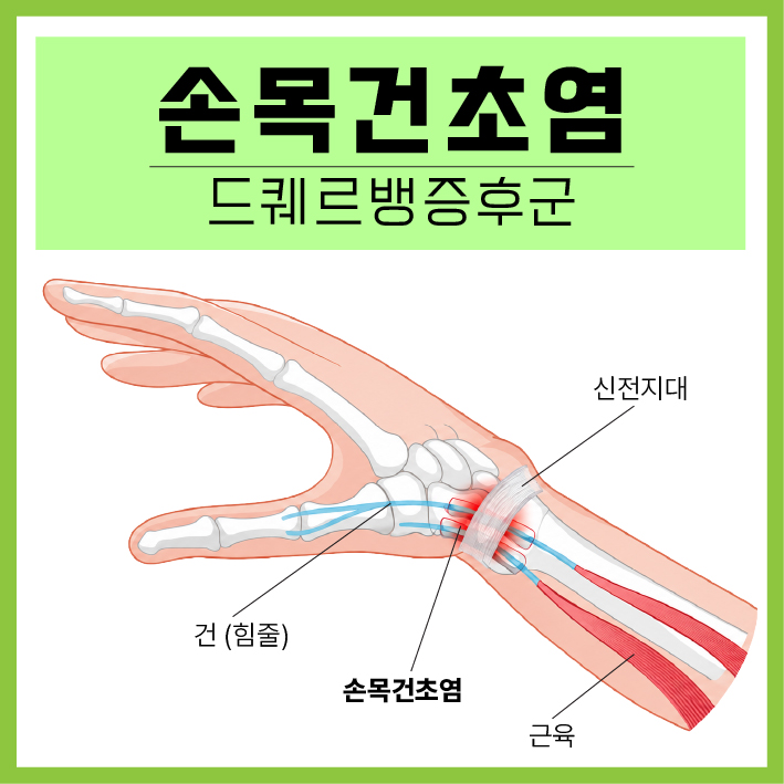 b1da76e99d26626.jpg